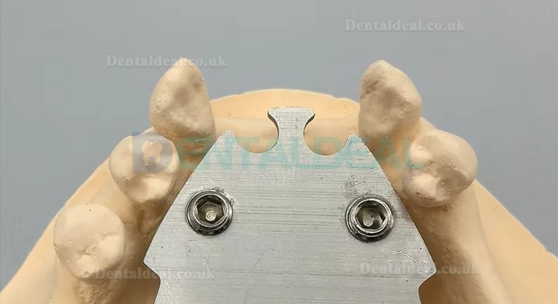 Dental Gothic Arch Tracer for Vertical Centric Recording